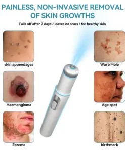 𝐉𝐚𝐬𝐬𝐞𝐞𝐦® 𝐍𝐨𝐧-𝐈𝐧𝐯𝐚𝐬𝐢𝐯𝐞 𝐌𝐨𝐥𝐞 & 𝐖𝐚𝐫𝐭 𝐋𝐚𝐬𝐞𝐫 𝐑𝐞𝐦𝐨𝐯𝐚𝐥 𝐏𝐞𝐧