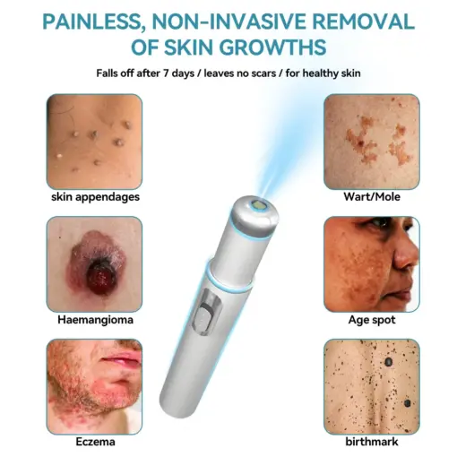 𝐉𝐚𝐬𝐬𝐞𝐞𝐦® 𝐍𝐨𝐧-𝐈𝐧𝐯𝐚𝐬𝐢𝐯𝐞 𝐌𝐨𝐥𝐞 & 𝐖𝐚𝐫𝐭 𝐋𝐚𝐬𝐞𝐫 𝐑𝐞𝐦𝐨𝐯𝐚𝐥 𝐏𝐞𝐧