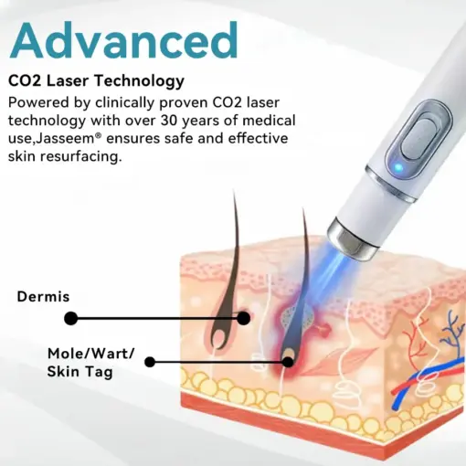 𝐉𝐚𝐬𝐬𝐞𝐞𝐦® 𝐍𝐨𝐧-𝐈𝐧𝐯𝐚𝐬𝐢𝐯𝐞 𝐌𝐨𝐥𝐞 & 𝐖𝐚𝐫𝐭 𝐋𝐚𝐬𝐞𝐫 𝐑𝐞𝐦𝐨𝐯𝐚𝐥 𝐏𝐞𝐧