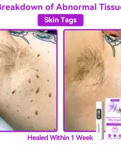 𝐉𝐚𝐬𝐬𝐞𝐞𝐦® Advanced Non-Invasive Skin Repair CO₂ Laser Pen