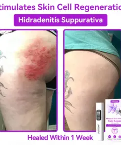 𝐉𝐚𝐬𝐬𝐞𝐞𝐦® Advanced Non-Invasive Skin Repair CO₂ Laser Pen