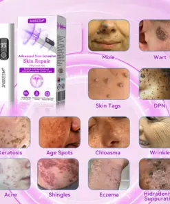 𝐉𝐚𝐬𝐬𝐞𝐞𝐦® Advanced Non-Invasive Skin Repair CO₂ Laser Pen