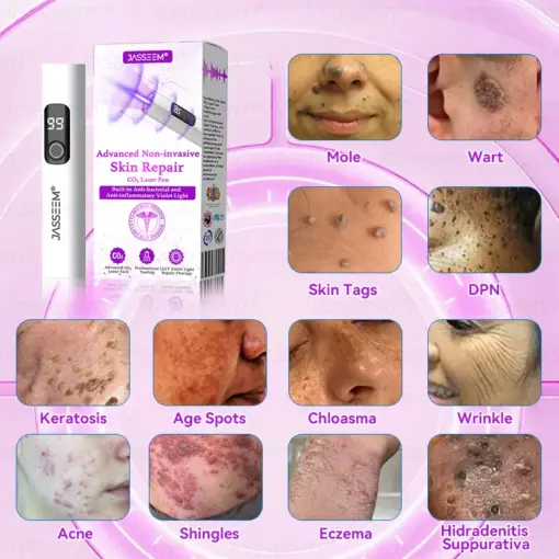 𝐉𝐚𝐬𝐬𝐞𝐞𝐦® Advanced Non-Invasive Skin Repair CO₂ Laser Pen