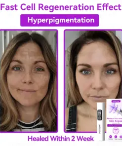 𝐉𝐚𝐬𝐬𝐞𝐞𝐦® Advanced Non-Invasive Skin Repair CO₂ Laser Pen