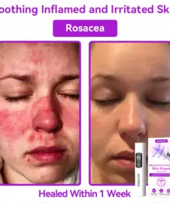𝐉𝐚𝐬𝐬𝐞𝐞𝐦® Advanced Non-Invasive Skin Repair CO₂ Laser Pen