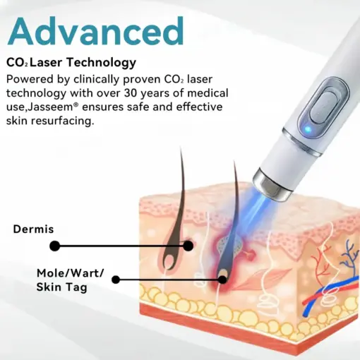 𝐉𝐚𝐬𝐬𝐞𝐞𝐦® Medical-Grade Laser Pen