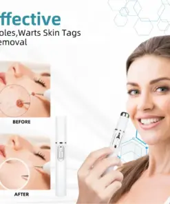 𝐉𝐚𝐬𝐬𝐞𝐞𝐦® Medical-Grade Laser Pen