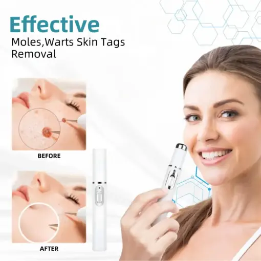 𝐉𝐚𝐬𝐬𝐞𝐞𝐦® Medical-Grade Laser Pen
