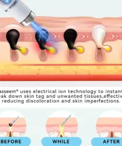 𝐉𝐚𝐬𝐬𝐞𝐞𝐦® Medical-Grade Laser Pen