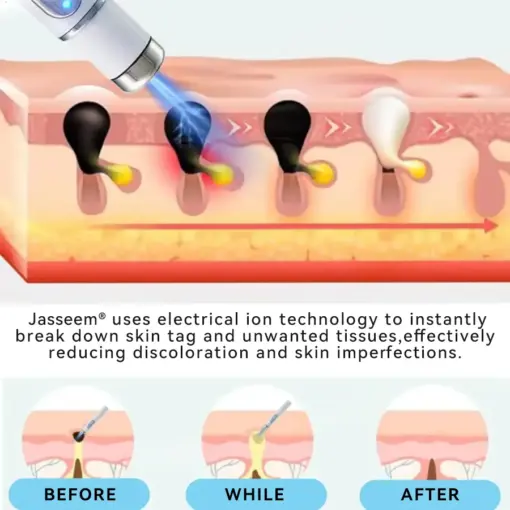 𝐉𝐚𝐬𝐬𝐞𝐞𝐦® Medical-Grade Laser Pen
