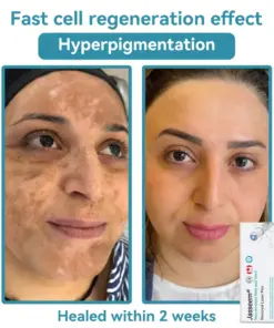 𝐉𝐚𝐬𝐬𝐞𝐞𝐦® Medical-Grade Laser Pen
