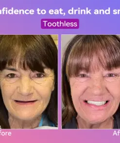 𝐉𝐚𝐬𝐬𝐞𝐞𝐦® Latest Premium Comfort Dentures