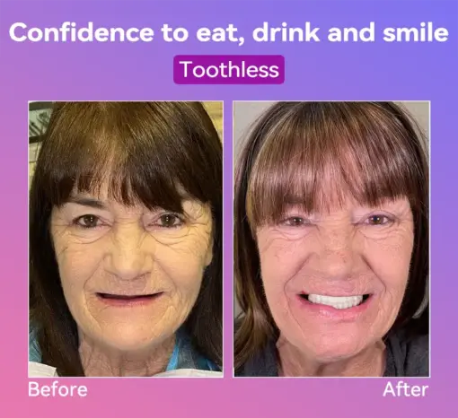 𝐉𝐚𝐬𝐬𝐞𝐞𝐦® Latest Premium Comfort Dentures