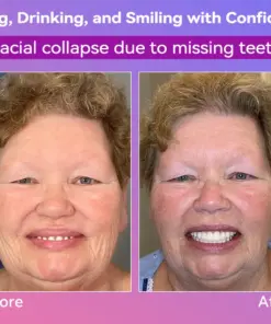 𝐉𝐚𝐬𝐬𝐞𝐞𝐦® Latest Premium Comfort Dentures