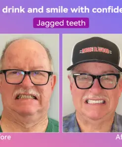 𝐉𝐚𝐬𝐬𝐞𝐞𝐦® Latest Premium Comfort Dentures