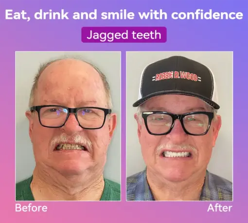 𝐉𝐚𝐬𝐬𝐞𝐞𝐦® Latest Premium Comfort Dentures