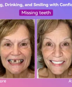 𝐉𝐚𝐬𝐬𝐞𝐞𝐦® Latest Premium Comfort Dentures