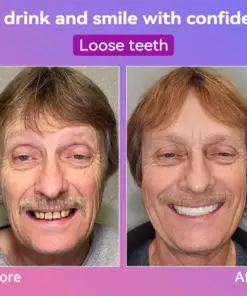 𝐉𝐚𝐬𝐬𝐞𝐞𝐦® Latest Premium Comfort Dentures