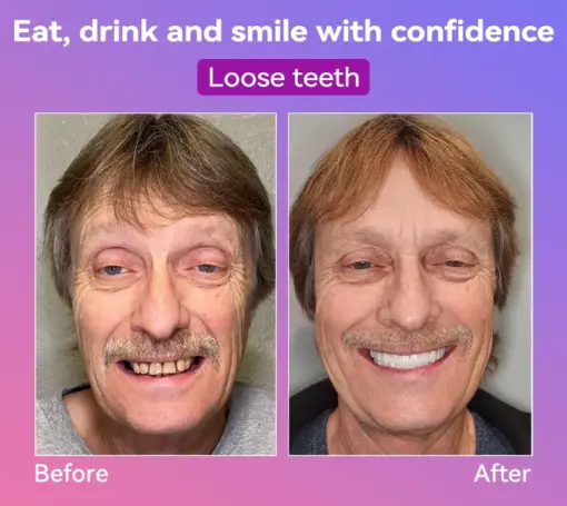 𝐉𝐚𝐬𝐬𝐞𝐞𝐦® Latest Premium Comfort Dentures