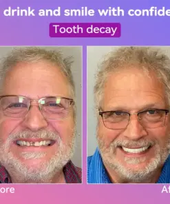 𝐉𝐚𝐬𝐬𝐞𝐞𝐦® Latest Premium Comfort Dentures