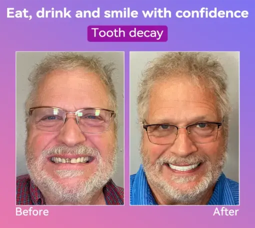 𝐉𝐚𝐬𝐬𝐞𝐞𝐦® Latest Premium Comfort Dentures