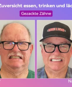 𝐉𝐚𝐬𝐬𝐞𝐞𝐦® Neueste Premium-Komfort-Zahnersätze