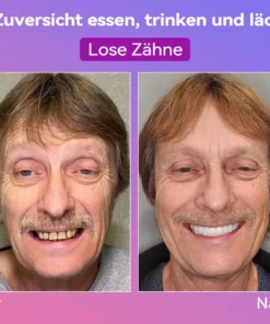 𝐉𝐚𝐬𝐬𝐞𝐞𝐦® Neueste Premium-Komfort-Zahnersätze