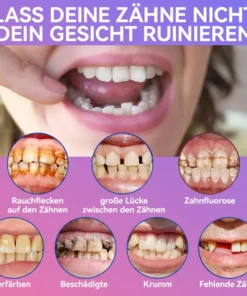 𝐉𝐚𝐬𝐬𝐞𝐞𝐦® Neueste Premium-Komfort-Zahnersätze