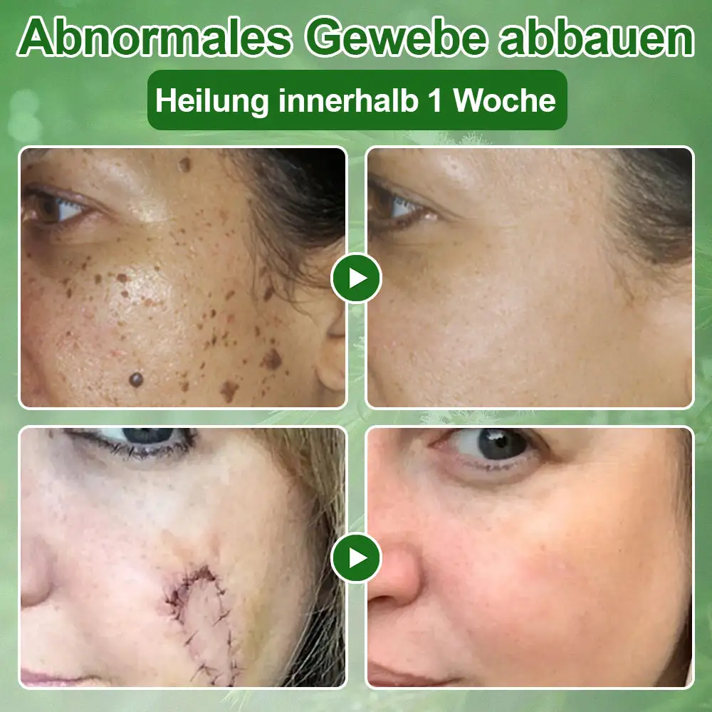 ๐๐๐๐๐๐ฎ๐ฆ๐จฬ๐ฅ ๐๐๐ฎ๐ญ๐ฉ๐๐ฅ๐๐ ๐๐๐๐ก๐๐ง๐๐ฅ๐ฎ๐ง๐ ๐๐ซ๐๐ฆ๐ - Image 5