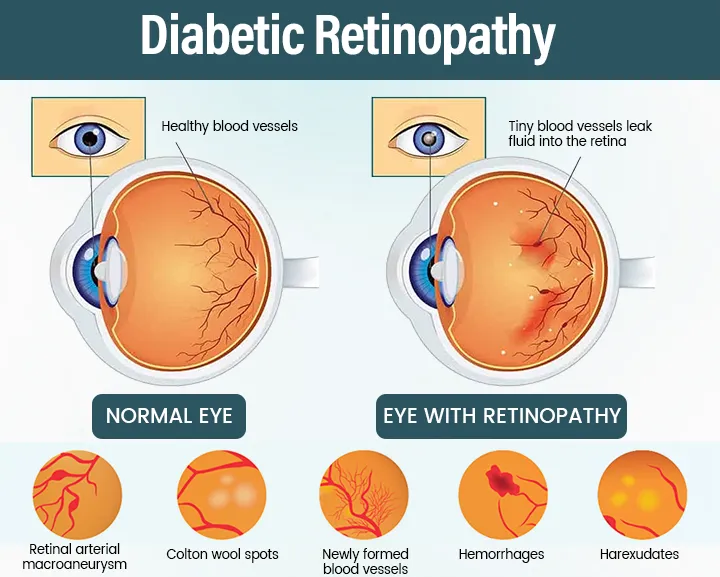 OptiFusion Nano Eye Drops Serum - Image 3