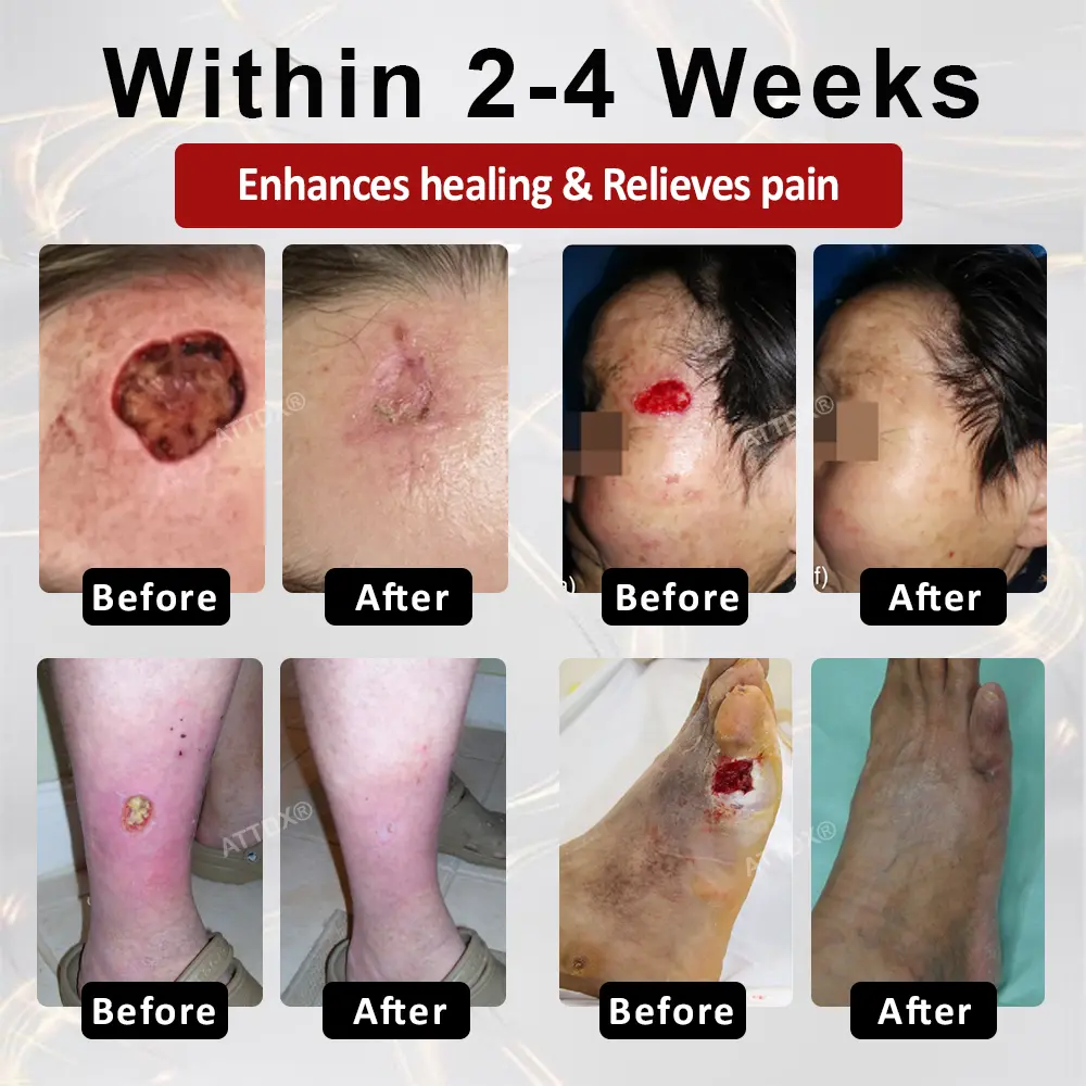 GlucoseGuard Skin Rescue Cream - Image 2