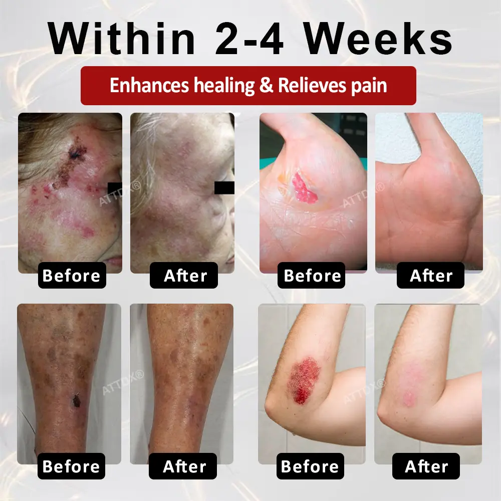 GlucoseGuard Skin Rescue Cream - Image 3