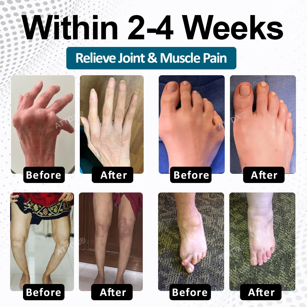 BPC-157 ArthroFlex Motion+ Capsules - Image 2