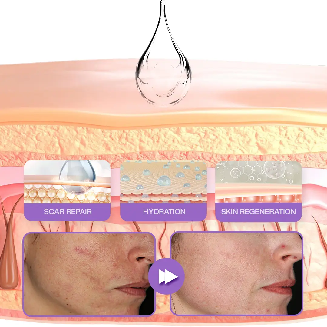 RevivaDerma Face & Body Scar Gel - Image 8