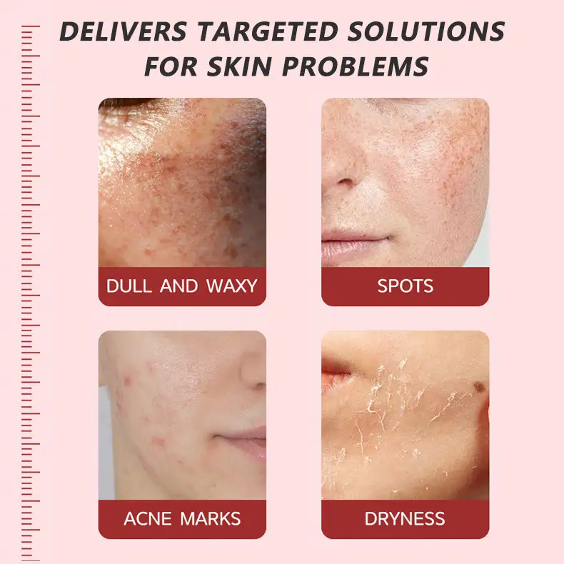 Pore & Spot Care Duo| Shrinks Pores & Fades Blemish Marks - Image 5