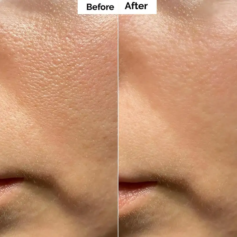 Pore & Spot Care Duo| Shrinks Pores & Fades Blemish Marks - Image 7