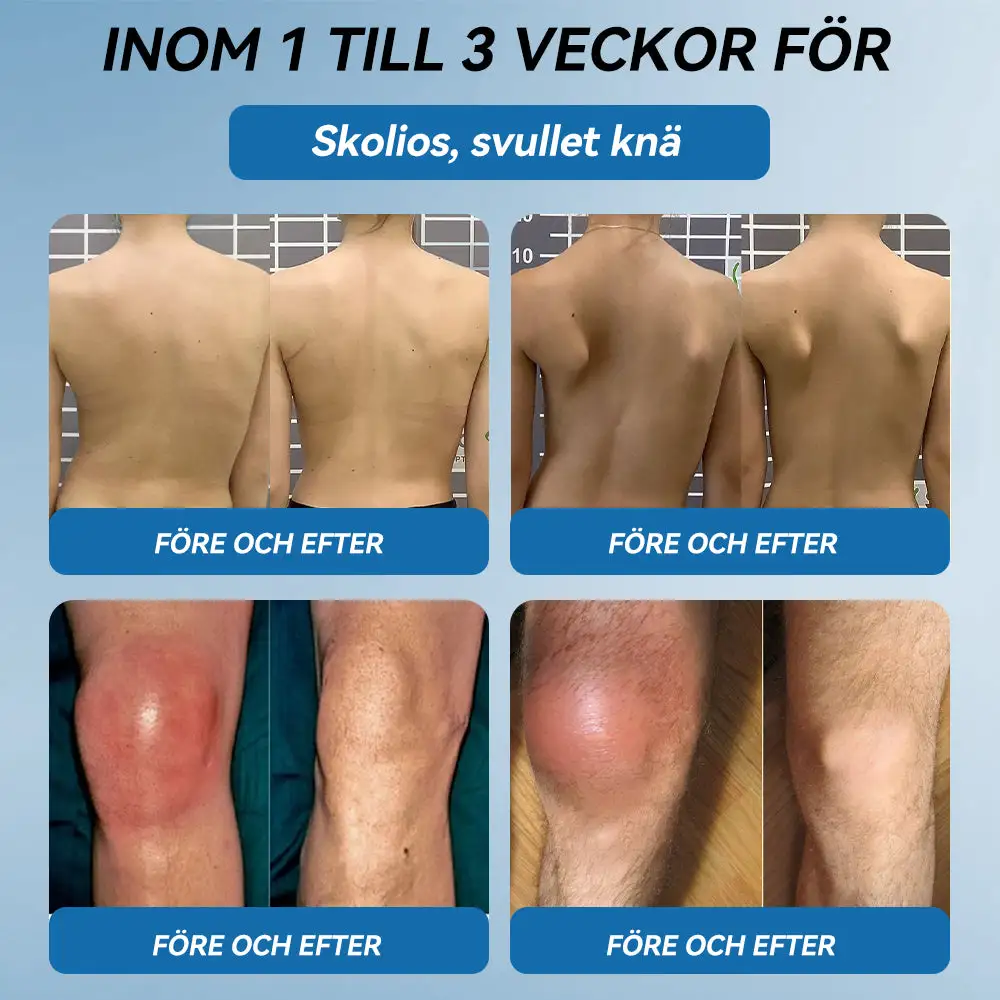 BPC-157 Ledhälsande kräm - Image 5