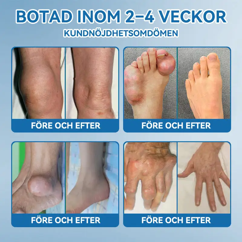 BPC-157 Ledhälsande kräm - Image 8