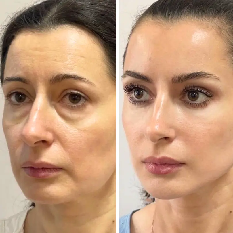 LiftRenew All-in-One Augenpflege-Stift - Image 2