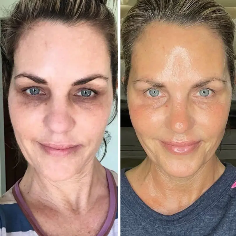 LiftRenew All-in-One Augenpflege-Stift - Image 4