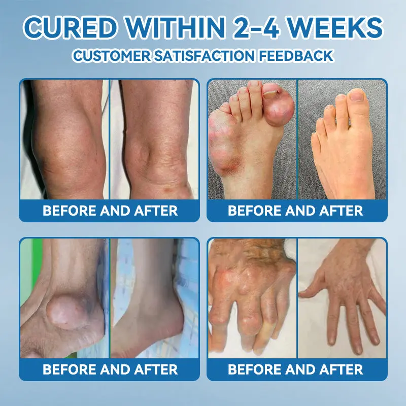 ʙ.ᴘ.ᴄ-157 Joint Healing Cream - Image 5