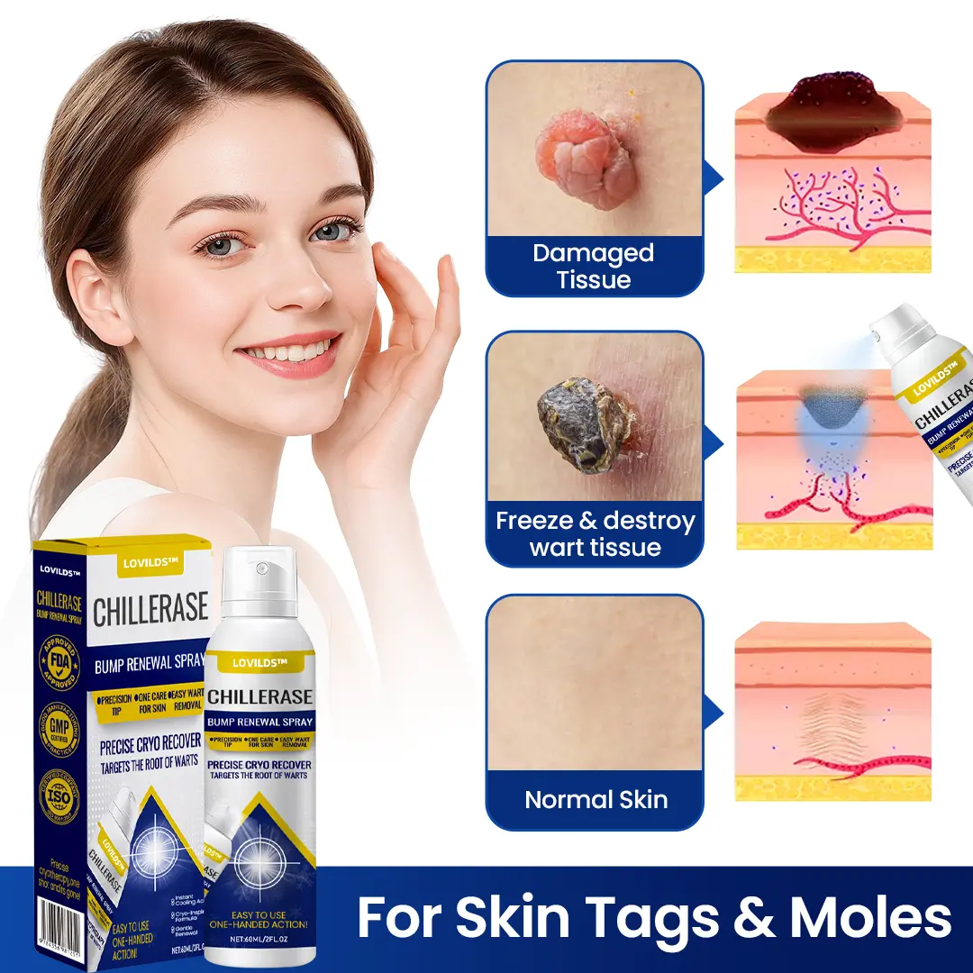 ChillErase Bump Renewal Spray - Image 4