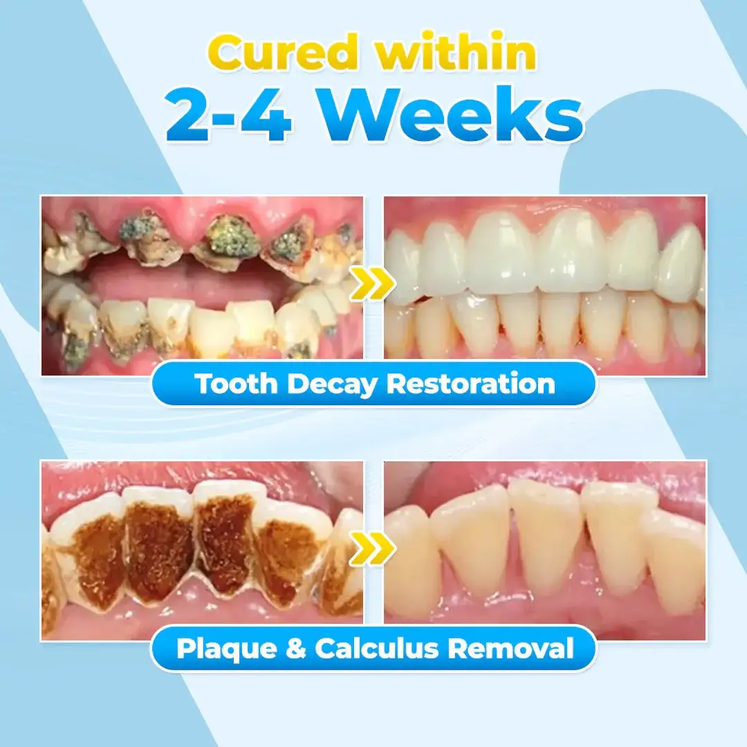 Bee Venom Gum Repair Powder - Image 4