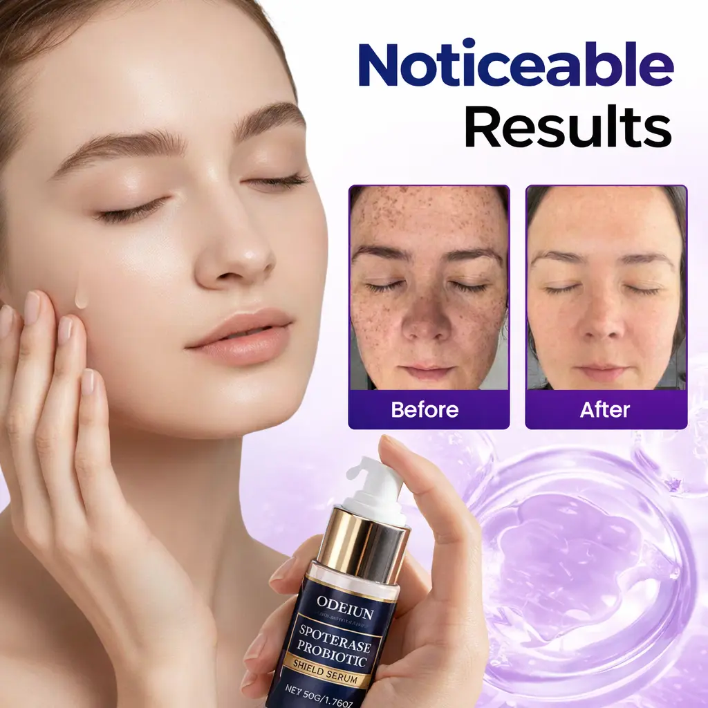 Spot Erasure Probiotic Shield Serum - Image 6