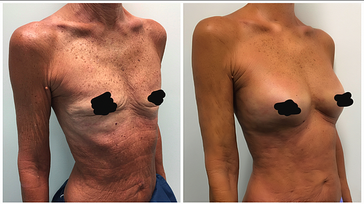 Natural Detox Slimming & Breast Enhancement Capsules - Image 3