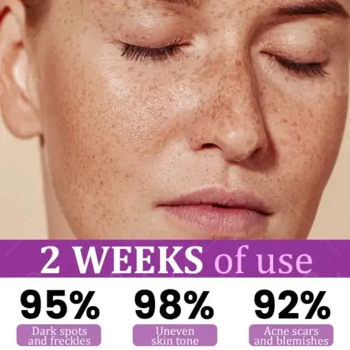 MelantraX Advanced Anti-Hyperpigmentation Essence - Image 2