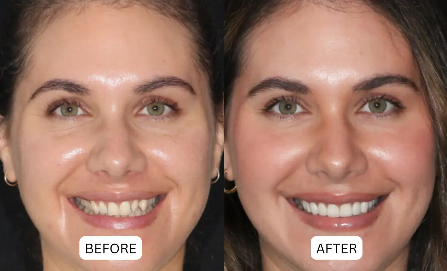 Teeth Armor Drops - Image 12