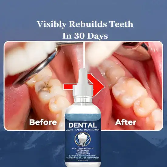 Teeth Armor Drops - Image 3