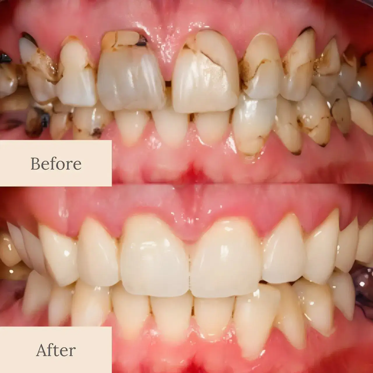 Teeth Armor Drops - Image 9