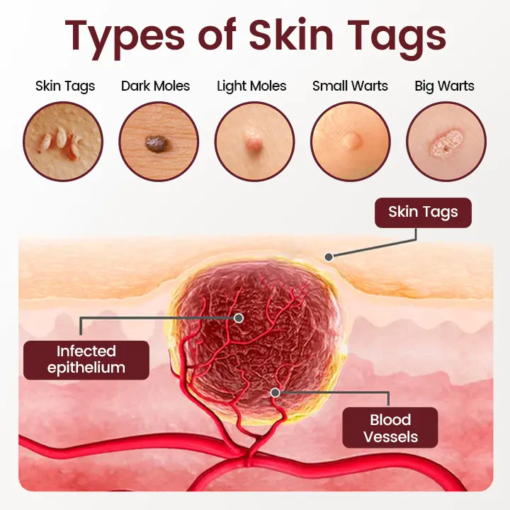 BumpAway Gentle Renewal Cream - Image 3